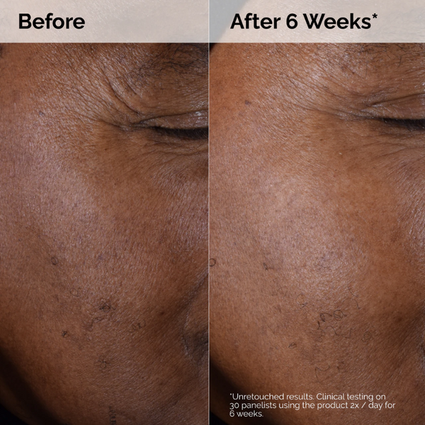 Mini Glycolic Acid 7% Exfoliating Toner