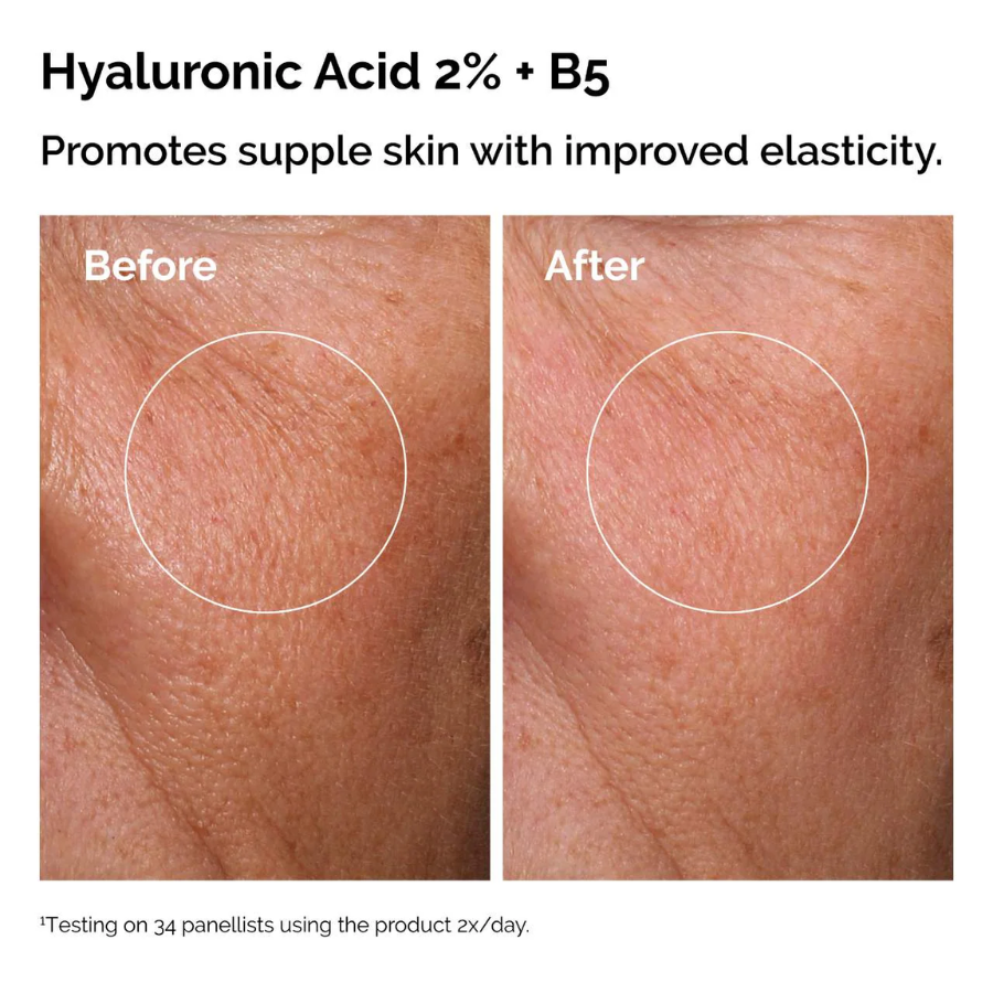 The Skin Support Set with Niacinamide + Hyaluronic Acid The Skin Support Set with Niacinamide + Hyaluronic Acid
