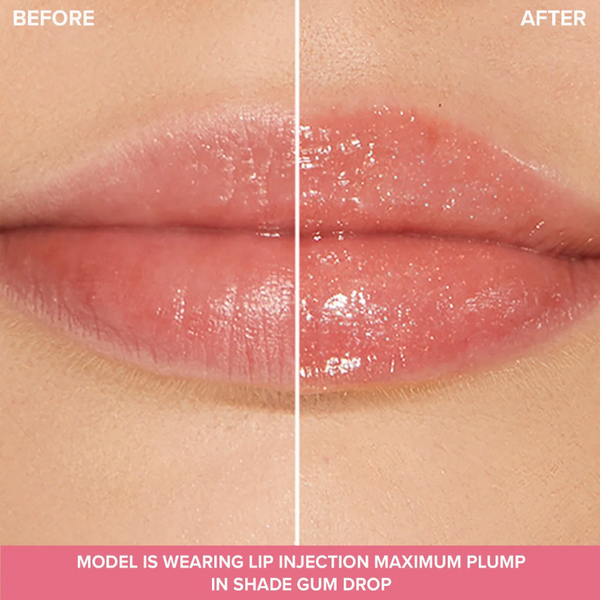 Lip Injection Maximum Plump