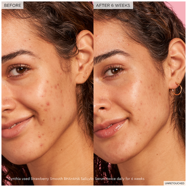 Strawberry Smooth BHA + AHA Salicylic Acid Serum